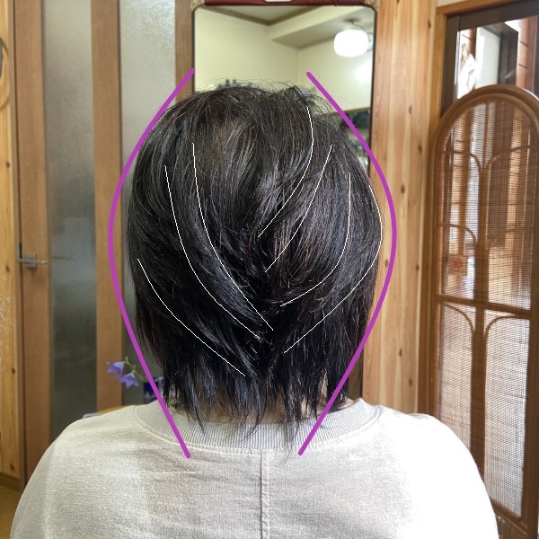 ひし形に近づけるための施術説明画像1